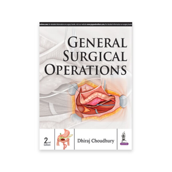 General Surgical Operations