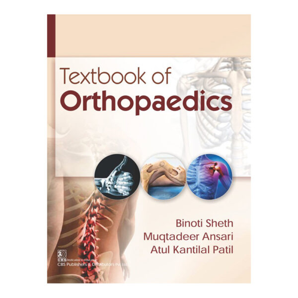 Textbook of Orthopaedics (PB)