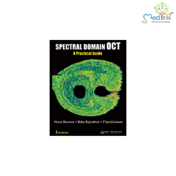 Spectral Domain OCT-A Practical Guide
