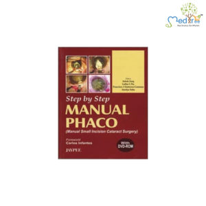 Step by Step Manual Phaco