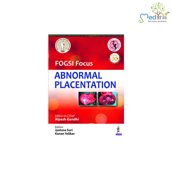 FOGSI Focus Abnormal Placentation