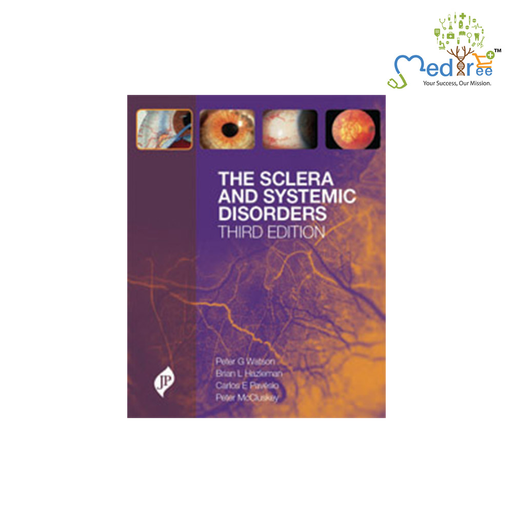 Buy The Sclera And Systemic Disorders 