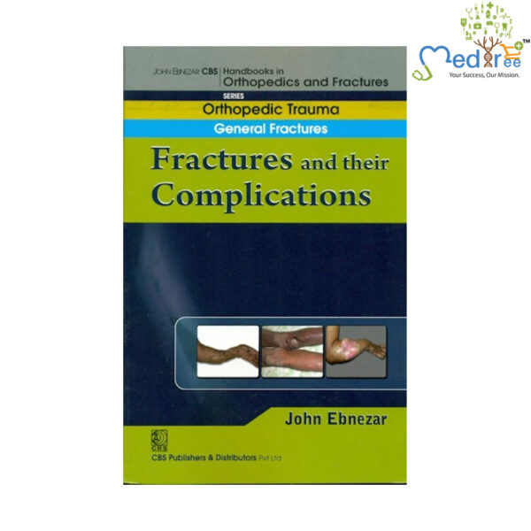 Fractures And Their Complications