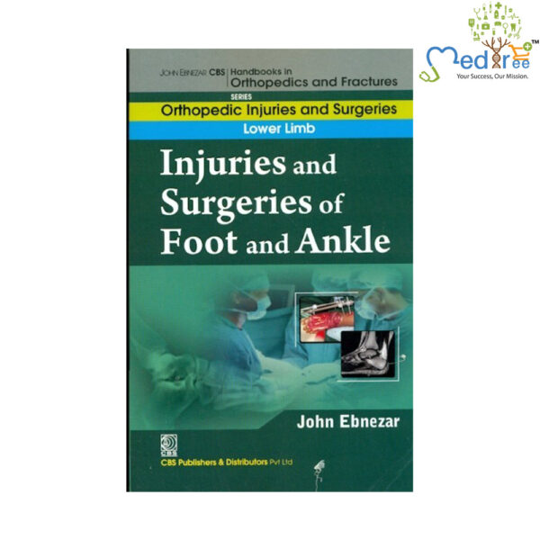 Injuries And Surgeries Of Foot And Ankle