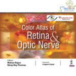 Color Atlas of Retina & Optic Nerve