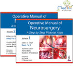 Operative Manual of Neurosurgery A Step by Step Pictorial Atlas