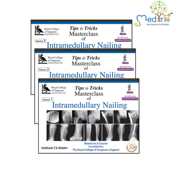 Tips & Tricks Masterclass of Intramedullary Nailing