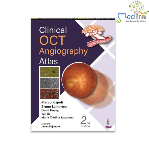 Clinical OCT Angiography Atlas