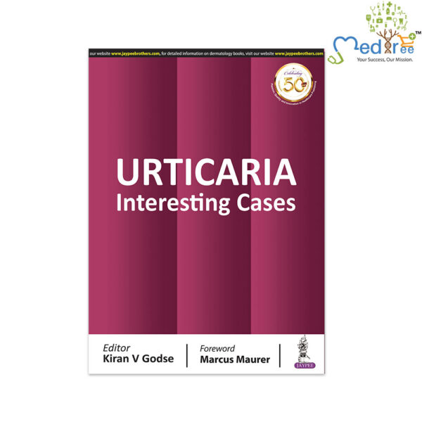 URTICARIA: Interesting Cases