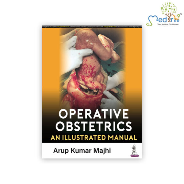 Operative Obstetrics: An Illustrated Manual