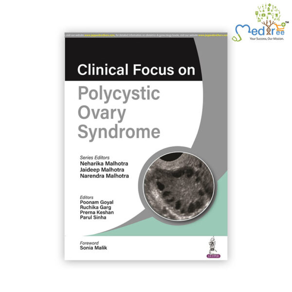 Clinical Focus on Polycystic Ovary Syndrome