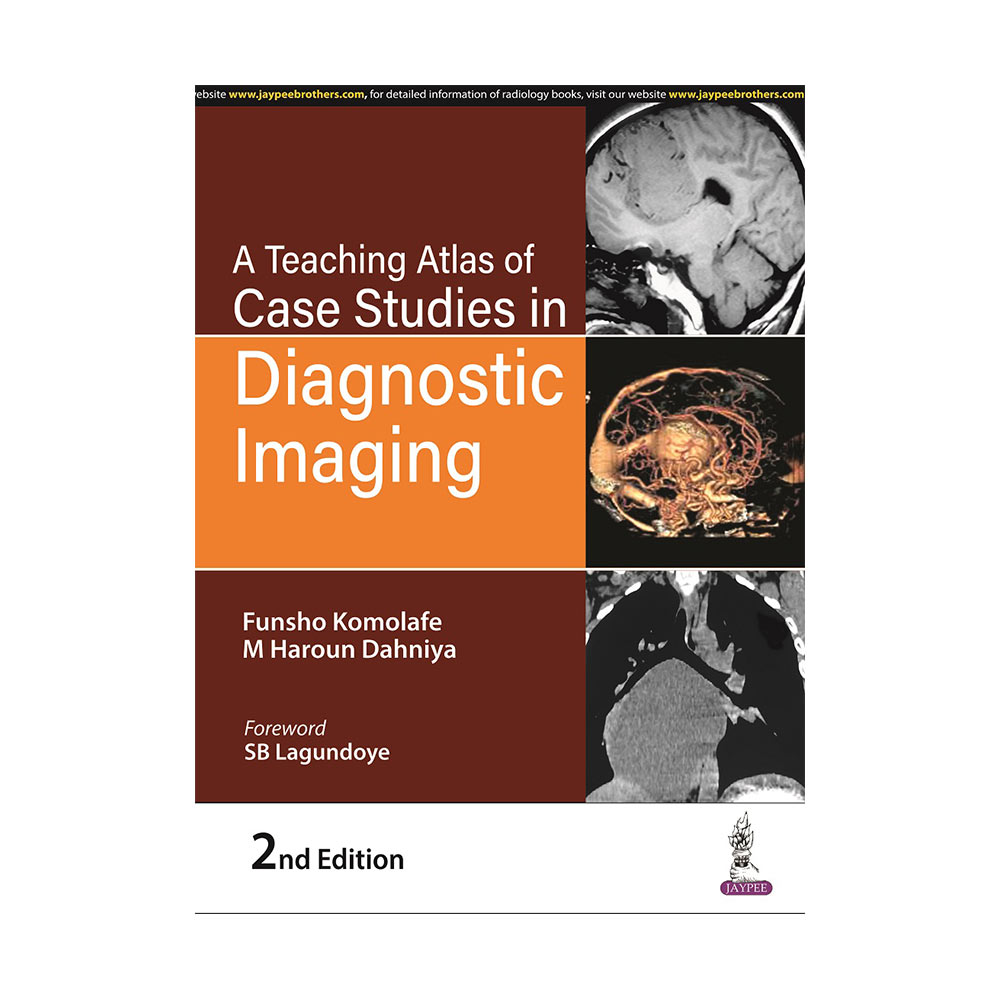 Buy　Case　A　Atlas　Diagnostic　Teaching　of　in　Studies　Imaging