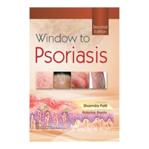 Window to Psoriasis 2nd/2022