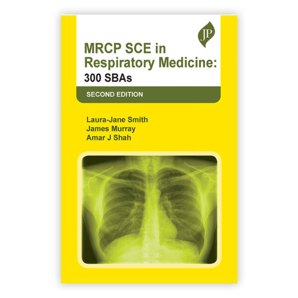 MRCP SCE in Respiratory Medicine: 300 SBAs