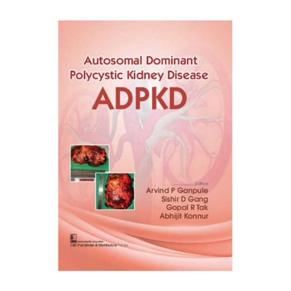 Autosomal Dominant Polycystic Kidney Disease ADPKD