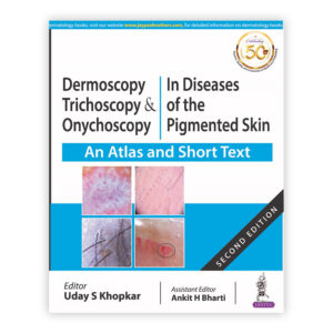 Dermoscopy, Trichoscopy & Onychoscopy in Diseases of the Pigmented Skin (An Atlas and Short Text)