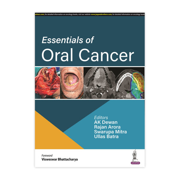 Essentials of Oral Cancer