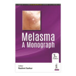 Melasma A Monograph