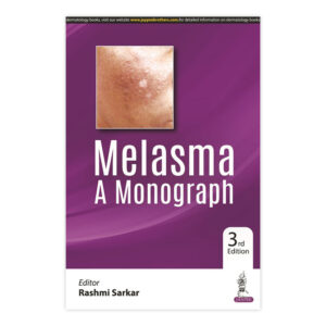 Melasma A Monograph