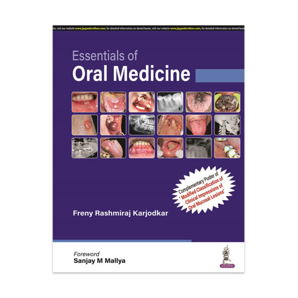 Essentials of Oral Medicine