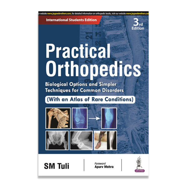 Practical Orthopedics: Biological Options and Simpler Techniques
