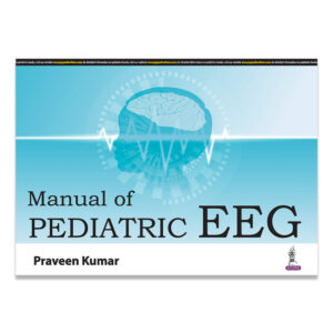 Manual of Pediatric EEG