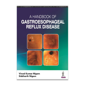 A Handbook of Gastroesophageal Reflux Disease