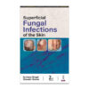 Superficial Fungal Infections of the Skin
