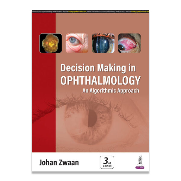 Decision Making in Ophthalmology: An Algorithmic Approach