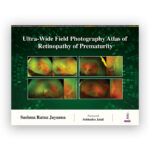 Ultra-Wide Field Photography Atlas of Retinopathy of Prematurity