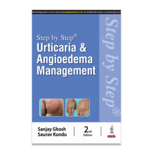 Step By Step Urticaria And Angioedema Management