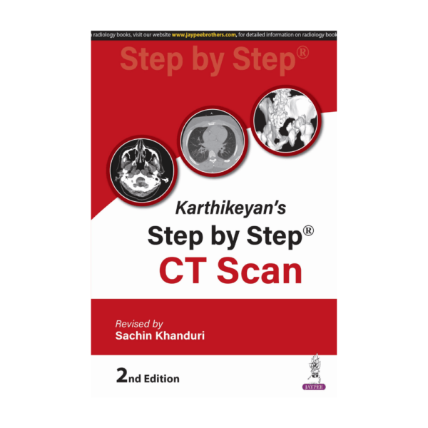 Karthikeyans Step by Step CT Scan 2nd/2025