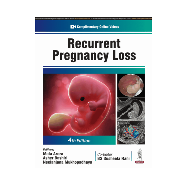 Recurrent Pregnancy Loss 4th/2025